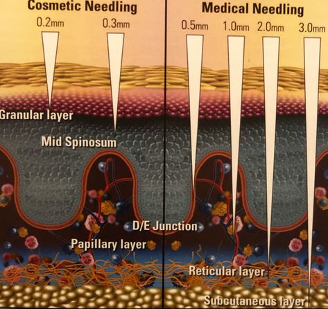 Microneedling Depth Chart, Microneedling Video, Microneedling Aesthetic, Microneedling At Home, Microneedling Serum, Dermapen Microneedling, Skin Facts, Skin Moles, Subcutaneous Tissue