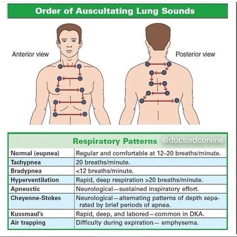 Orders of Auscultating Lungs Sound and different Respiratory Patterns... #auscultation #sound #lungs #respiratory #physiology #diagnosis… Auscultating Lung Sounds, Lung Sounds, Nursing Information, Nursing Assessment, Nursing Mnemonics, Nursing School Survival, Respiratory Therapy, Nursing School Studying, Nursing School Tips