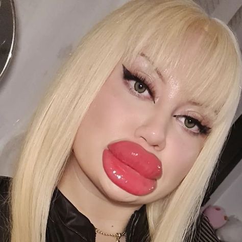 Huge Lip Fillers, Big Lips Funny, Bad Lip Filler, Big Lips Girl, Accepting Imperfection, Extreme Plastic Surgery, Art Pictures Ideas, Funny Lips, Botox Lips