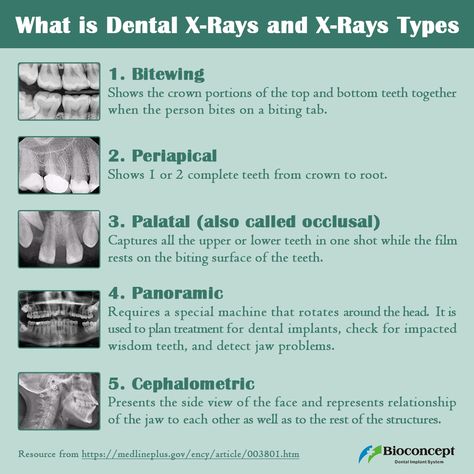 Dental Assistant Radiology Study, Dental Xrays Tips, Dental Radiology Study, Dental Nurse Revision, Radiology Dental, Dental Assistant Study Notes, Cbct Dental, Dental Radiology, Dental Radiography