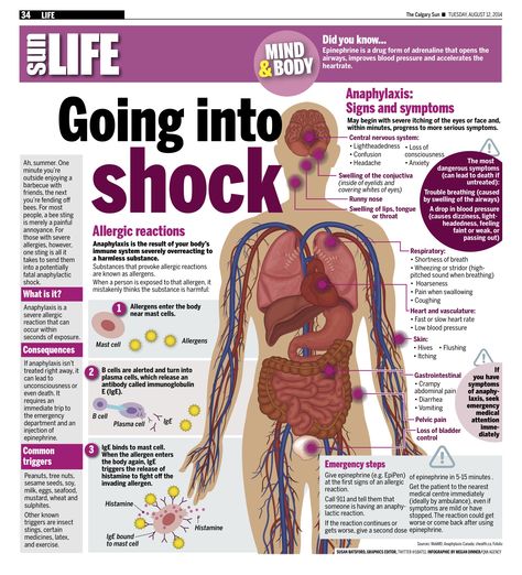 Ah, summer. One minute you’re outside enjoying a barbecue with friends, the next you’re fending off bees. For most people, a bee sting is merely a painful annoyance. For those with severe allergies, however, one sting is all it takes to send them into a potentially fatal anaphylactic shock. Barbecue With Friends, Public Health Nurse, First Aid Tips, Anaphylactic Shock, Emergency Binder, Emergency Prepardness, Medical Facts, Medical School Essentials, Emergency Preparation