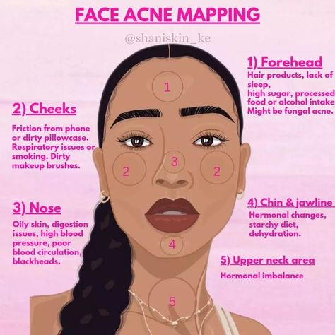 Face Breakout Chart, Acne On Face Meaning, Acne Mapping Face, Things That Help With Acne, Break Out Zones Face, Skin Problems Face, Acne Map, Girly Skincare, Skin Care Products Aesthetic