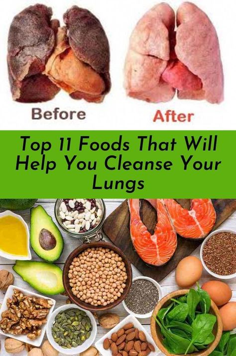 Find out about Top 11 Foods That Will Help You Cleanse Your Lungs Simply click here for more. Hair Growth Home Remedies, Home Remedies For Acne, Cold Home Remedies, Upset Stomach, Body Pain, Healthy Lifestyle Tips, Diy Health, Health Info, Lungs