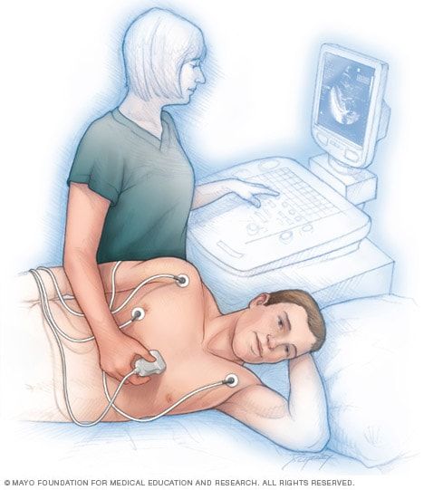 Echocardiogram - Mayo Clinic Heart Echo, Live Images, Heart Valves, Heart Conditions, Heart Surgery, Heart Problems, Production Design, Mayo Clinic, Sound Waves