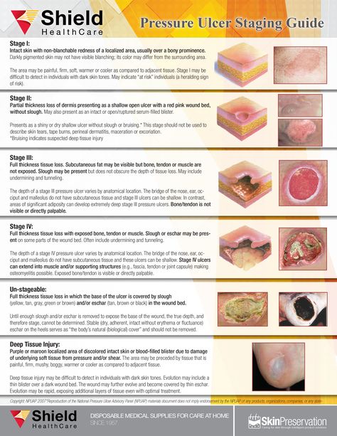 Pressure Wound Stages Wound Nurse, Pressure Ulcer Staging, Pressure Injury, Wound Management, Wound Care Nursing, Home Health Nurse, Nursing Information, Med Surg Nursing, Nursing Humor