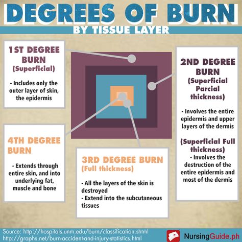 Burns Nursing, Types Of Burns, Ahg Badge, Paramedic School, Nursing Information, Nursing Fun, New Grad Nurse, Nurse Study Notes, Nursing Mnemonics