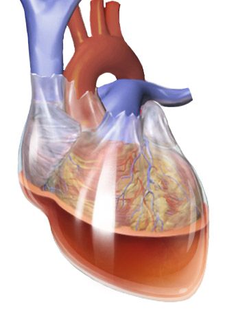 cardiac tamponade Cardiac Cath, Cardiac Step Down Unit, Cardiac Tamponade, Cardiac Dysrhythmias, Cardiac Dysrhythmias Nursing, Pericardial Effusion, Emt Study, Brain Surgeon, Cardiac Nursing