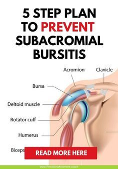 Don't give in to shoulder pain! Here's are some effective ways to treat and prevent subacromial bursitis. @pmovementcoach #shoulderpain #subacromial #bursitis Subacromial Bursitis, Shoulder Bursitis, Frozen Shoulder Exercises, Bursitis Shoulder, Shoulder Rehab Exercises, Shoulder Anatomy, Rotator Cuff Exercises, Shoulder Pain Exercises, Shoulder Rehab