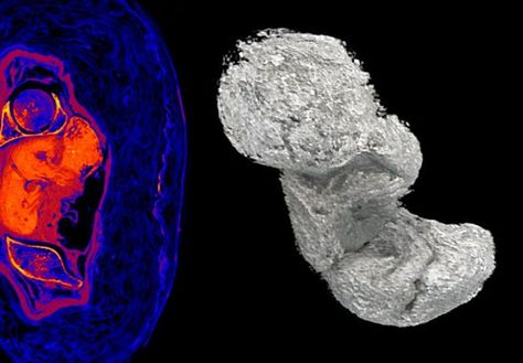 Ancient Egyptian fetus preserved due to unusual decomposition process - HeritageDaily - Archaeology News Biological Anthropology, Ancient Civilisations, Egyptian Mummies, Archaeology News, Fetal Development, Science Articles, Header Image, Unique Recipes, Ancient Civilizations