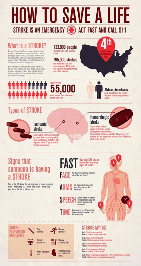 Infographic for American Stroke Prevention Scientific Poster Design, Info Poster, Types Of Strokes, Scientific Poster, Research Poster, Graphic Design Infographic, Infographic Poster, Medical Knowledge, Data Visualization