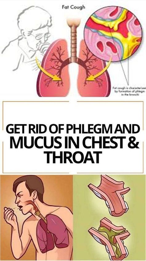 Mucus accumulations make you feel as if there’s something stuck in your throat. You sense an urge to clear your throat, and it’s really frustrating. This problem is usually created by infections in the upper respiratory tract, but mucus accumulations may be triggered by allergies, asthma, and he... Mucus In Chest, Mucus In Throat, Chest Congestion Remedies, Mucus Relief, Getting Rid Of Phlegm, Home Remedies For Bronchitis, Sinus Congestion Relief, Toddler Cough Remedies, Congestion Relief