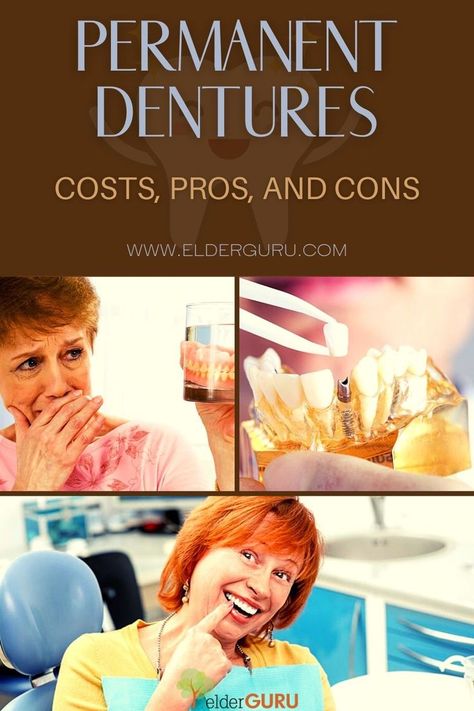 False Teeth Options, Soft Foods After Surgery Teeth Dentures, Dentures Before And After, Dentures Before And After Immediate, Dentures Tips, Permanent Dentures, Dental Dentures, Affordable Dentures, Tooth Extraction Healing