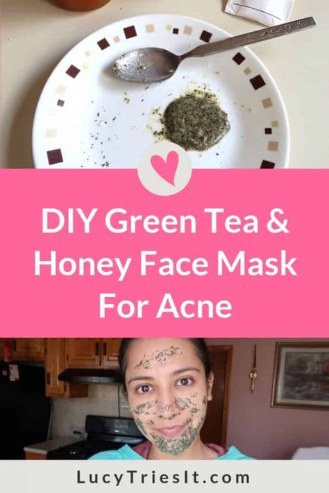 Are you experiencing acne inflammation? Then you might want to try this DIY green tea and honey face mask recipe. Once you experience the skincare benefits of this mask, you’ll be sure to make it a regular in your beauty routine. Click to learn how to make this awesome natural face mask for acne! #DIYskincare #acne Diy Green Tea, Honey Skincare, Face Mask For Acne, Mask For Acne, Green Tea And Honey, Honey Face Mask, Tumeric Face Mask, Acne Face Mask, Natural Face Mask