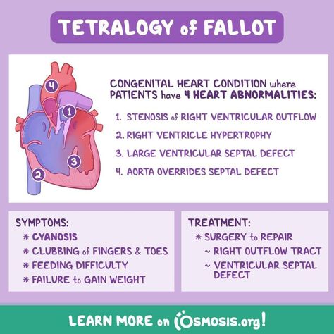 Pediatric Cardiovascular Disorders, Veterinary Notes, Pediatric Cardiology, Nursing School Studying Cheat Sheets, Cardiology Nursing, Nurse Skills, Ultrasound Sonography, Nursing School Essential, Nursing Study Guide