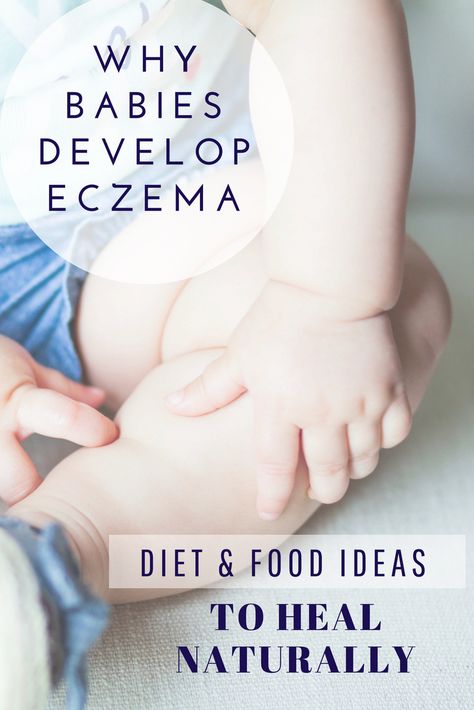 Baby Eczema Causes and Triggers, Diet And Food Recipe Ideas To Heal Naturally (Including for nursing mothers, Infants, and Toddlers ). Learn more about baby eczema and gut connection.  #healthyeating #naturalremedies #eczema #babyfood #baby Lei Lei, Baby Recipes, Home Remedies For Skin, Healthy Baby Food, Baby Foods, Nursing Mother, Baby Development, Mom Hacks, Healthy Babies