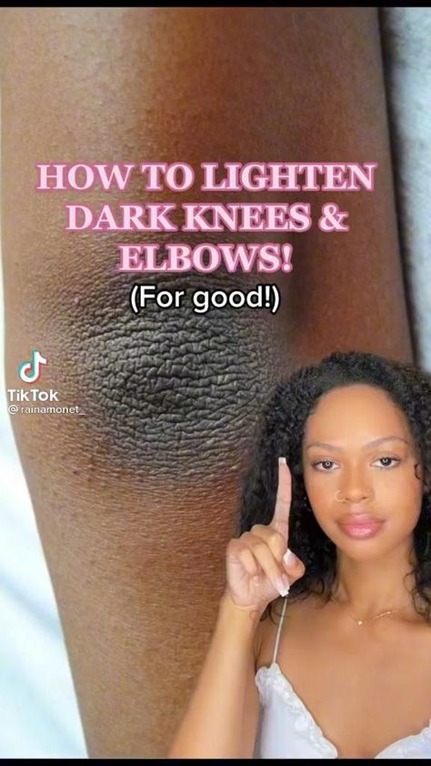 Dark Knees, Haut Routine, Skin Advice, Latihan Kardio, Clear Healthy Skin, Natural Face Skin Care, Serious Skin Care, Basic Skin Care Routine, Clear Skin Tips