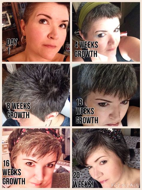 Growing Out A Shaved Head Women, Growing Buzzcut Hairstyle, Shaved Head Grow Out Stages, How To Grow Out A Buzzcut Women, Shaved Hair Growing Out, Platinum Buzzcut Women, Buzzcut Grow Out, Buzz Cut Women Growing Out, Growing Out Buzzcut Women