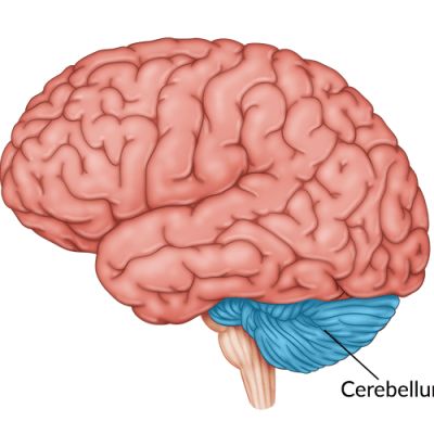 Foods That Help Stroke Recovery: 15 Evidence-Backed Options Types Of Strokes, Cerebral Cortex, Vision Therapy, Cognitive Therapy, Physical Therapy Exercises, Brain Stem, Memory Problems, Visual Memory, Improve Cognitive Function