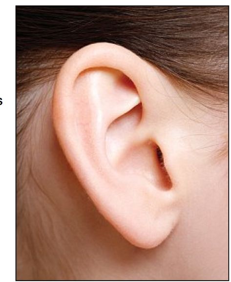 Middle Ear, Ear Wax Removal, Ear Wax, Hearing Loss, Hearing Aids, Blood Flow, Medical Conditions, Your Head, Daily Mail