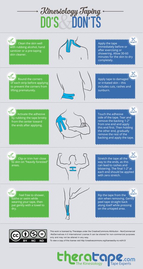 Kinesiology Taping Do's and Don't Infographic from Theratape.com K Tape, Kinesio Taping, Sports Tape, Kinesiology Taping, Athletic Training, Sports Medicine, Physical Therapist, Reflexology, Massage Therapy