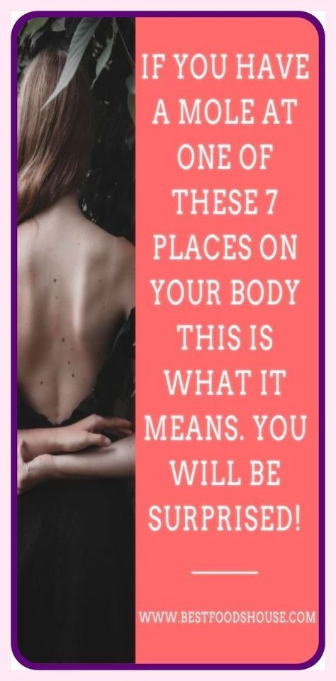 IF YOU HAVE A MOLE AT ONE OF THESE 7 PLACES ON YOUR BODY THIS IS WHAT IT MEANS-YOU WILL BE SURPRISED Mole Meaning, Natural Remedies For Allergies, Turmeric Health, Natural Headache Remedies, Get Rid Of Warts, Quotes About Love And Relationships, Holistic Medicine, Wellness Tips, Healthy Tips