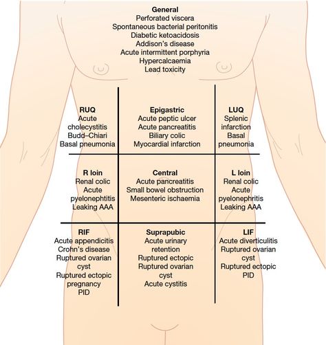 Acute abdominal pain and starting DDX by quadrant Surgical Technologist Student, Quadrants Of The Abdomen, Physician Assistant Student, Nerdy Nurse, Pa Life, Surgical Technician, Operating Room Nurse, Surgical Technologist, Addisons Disease