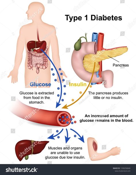 Sistem Pencernaan, Medical Training, Vie Motivation, Medical Terms, Salford, Lower Blood Sugar, Blood Sugar, Eating Well, Fun To Be One