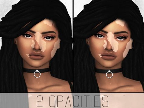 SimplyPixelated - Vitiligo Overlay Vilitigo Skin, Sims 4 Cc Vilitigo Skin, The Sims 4 Kids, Cc Skin, Maxis Match Cc, The Sims 4 Skin, Sims 4 Cc Kids Clothing, Makeup Cc, The Sims 4 Pc