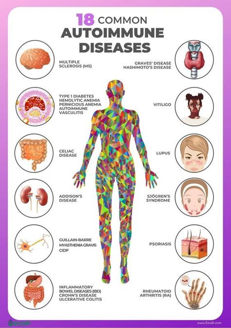 18 Common Autoimmune Diseases #medschool #doctor #medicalstudent - Image Credits: Audrey Herman Sjogrens Syndrome, Graves Disease, Silent Killer, Disease Symptoms, Gluten Sensitivity, Autoimmune Disorder, Medical Knowledge, Autoimmune Disease, Get A Tattoo