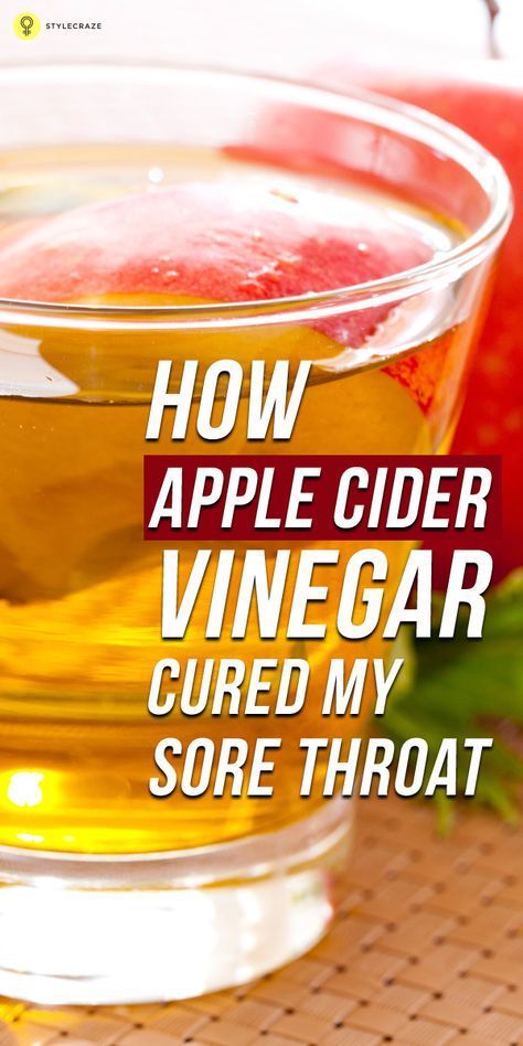 Apple Cider Vinegar Remedies, Throat Remedies, Sore Throat Remedies, Apple Cider Vinegar Drink, Healing Remedies, Natural Healing Remedies, Cough Remedies, Cold Remedies, Natural Therapy