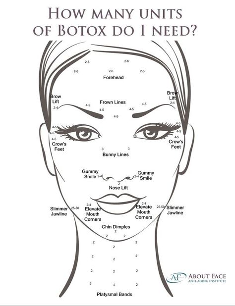 how many units of botox do i need Botox Forehead, Botox Injection Sites, Facial Injections, Botox Facial, Botox Brow Lift, Botox Before And After, Botox Lips, Aesthetic Dermatology, Facial Anatomy