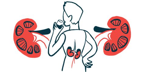 Pre-transplant PH Does Not Affect 5-year Survival After Kidney Transplant Kidney Biopsy, Acute Kidney Injury, Kidney Function, Kidney Damage, Western Medicine, Sleep Well, Get Your Life, Good Health, Chronic Illness