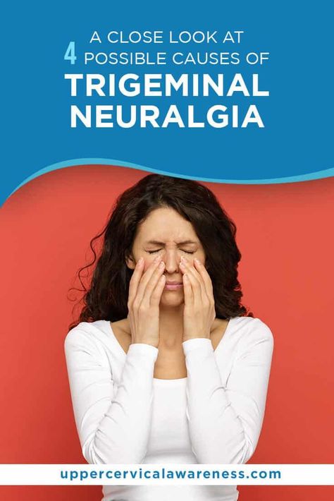 Trigeminal Nerve Pain, Trigeminal Neurology, Trigeminal Nerve Pain Relief, Upper Cervical Chiropractic, Forward Head Posture Exercises, Occipital Neuralgia, Neck And Shoulder Muscles, Facial Bones, Nerve Health