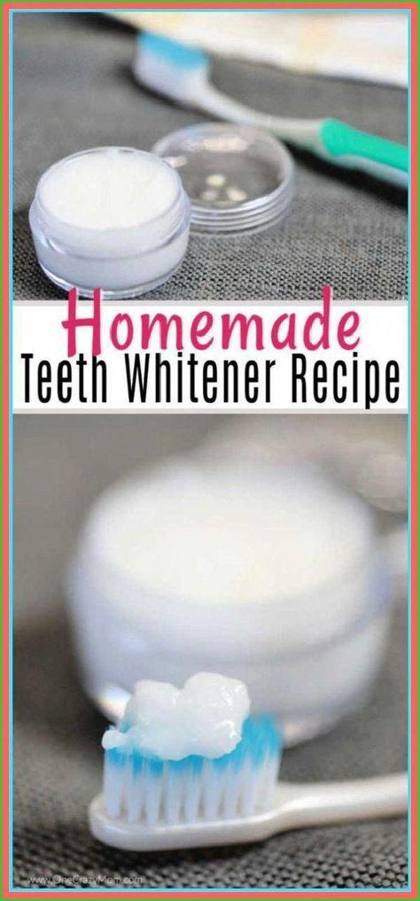 Naturally Whiten Teeth 10 Ways To Remove Tartar Stains From Your Teeth #WhatAreTheContraindicationsOfOralCare #WhatDoesOralHealthCareMean #PreventiveOralHealthCare At Home Teeth Whitening Diy, Home Teeth Whitening Diy, Naturally Whiten Teeth, Diy Teeth Whitening, At Home Teeth Whitening, Diy Teeth, Home Teeth Whitening, Teeth Whitening Homemade, Discolored Teeth