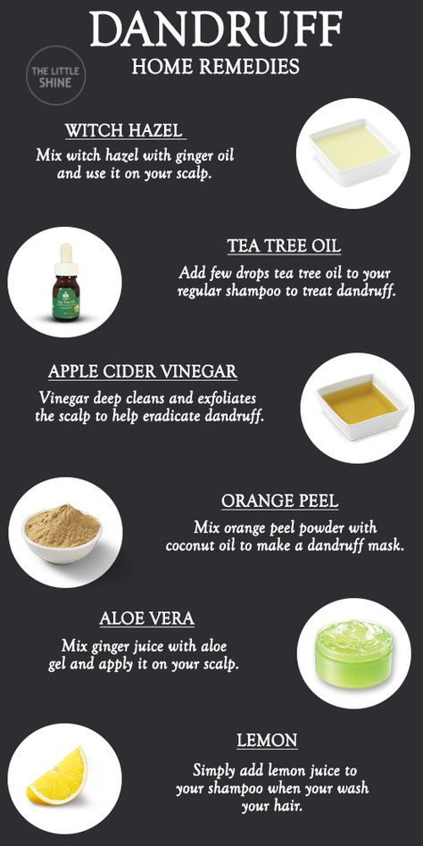 Alovera For Dandruff, How To Get Rid Of Hair Dandruff, How To Deal With Dandruff Dry Scalp, Get Rid Of Dandruff Naturally, Dandruff Remedy Diy How To Get Rid, What Helps With Dandruff, Instant Dandruff Removal, Best Remedy For Dandruff, Remedies For Dandruff And Itchy Scalp