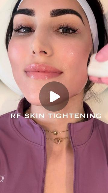 Sheila Shahram on Instagram: "Lately I’ve been obsessed with radio frequency skin tightening to help prevent jowls, sculpt my cheekbones, and keep this jawline snatched 👏🏽 

Thank you so much @nursefiona @nursefionaskin for keeping me looking and feeling 23 at 33 😋

🏷️ #facialtreatment #skintreatment #skintightening #rftreatment #antiaging #jawlinecontouring #facials #cheeklift #jowllift" Preparation H For Skin Tightening, Snatched Face, Facial Before And After, Radio Frequency Facial, Skin Recipes, Cheek Lift, Radio Frequency Skin Tightening, Tighten Facial Skin, Facial Tips