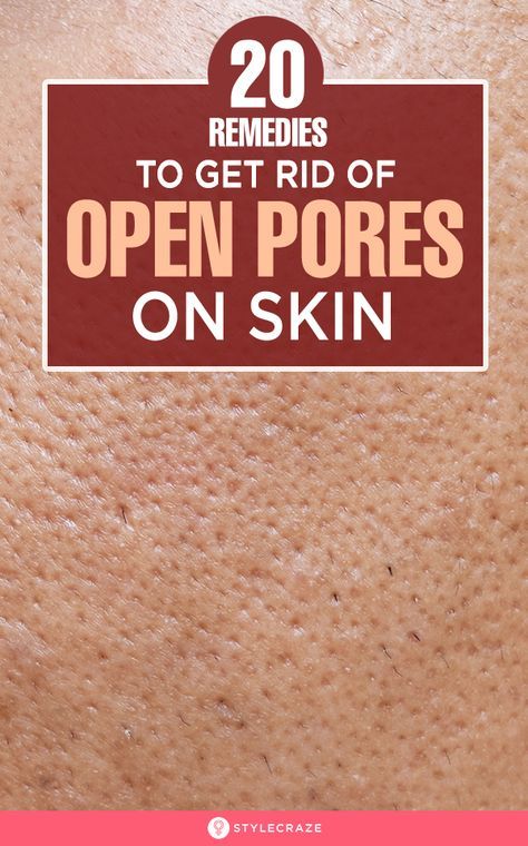 Get Rid Of Pores, Lotion For Oily Skin, Home Remedies For Skin, Face Pores, Open Pores, Diy Facial, Clear Pores, Healthy Advice, Moisturizer For Oily Skin