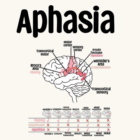 A look at Aphasia 🧠 Study Set Available on my TPT!🩷 . . . . . . . . . . #sIp #speechpathology #sIpgradstudent #sIpgradschool #gradstudent #Speechtherapy #sIpgradlife #speechlanguagepathology #speechlife #slptobe #bilingualslp #cuethespeech #aestheticanatomy #slpaesthetic #lifeisspeechie #fixasha #slpfinds #slpmusthaves #speechfinds #speechie #slpanatomy #anatomy Acute Care Slp, Slp Praxis Study Guide, Speech Therapist Aesthetic, Speech Therapy Aesthetic, Speech Pathology Aesthetic, Slp Aesthetic, Speech Language Pathology Grad School, Praxis Study, Speech Language Pathology Assistant