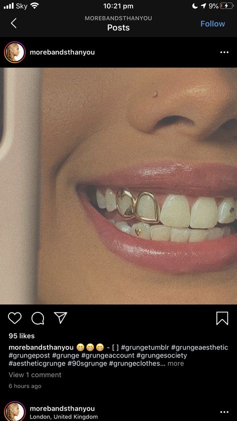 Tooth Gems Aesthetic, Girls With Grills, Gems Aesthetic, Open Face Grillz, Girl Grillz, Teeth Gems, Teeth Whitening Methods, Pretty Teeth, Teeth Whitening Procedure