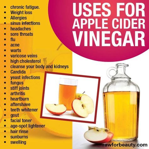 So many uses for apple cider vinegar! Create a healthy alkalizing drink by mixing 2tbsp with a glass of water and a bit of stevia to sweeten and sip. So many other uses! Apple Cider Vinegar Bath, Apple Cider Vinegar Uses, Apple Cider Vinegar Remedies, Water Retention Remedies, Candida Yeast Infection, Cider Vinegar Benefits, Candida Cleanse, Apple Cider Vinegar Benefits, Candida Yeast