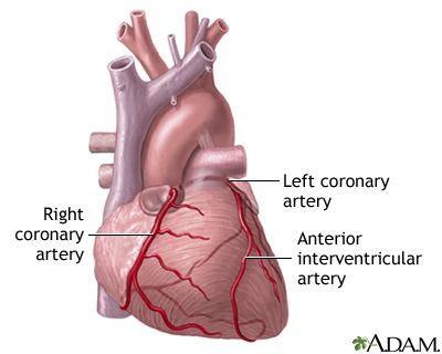 Heart attack and acute coronary syndrome | Lima Memorial Health System Heart Arteries, Acute Coronary Syndrome, Coronary Artery, Penyakit Jantung, Heart Muscle, Coronary Arteries, Cardiovascular System, Body Systems, Cardiovascular Disease