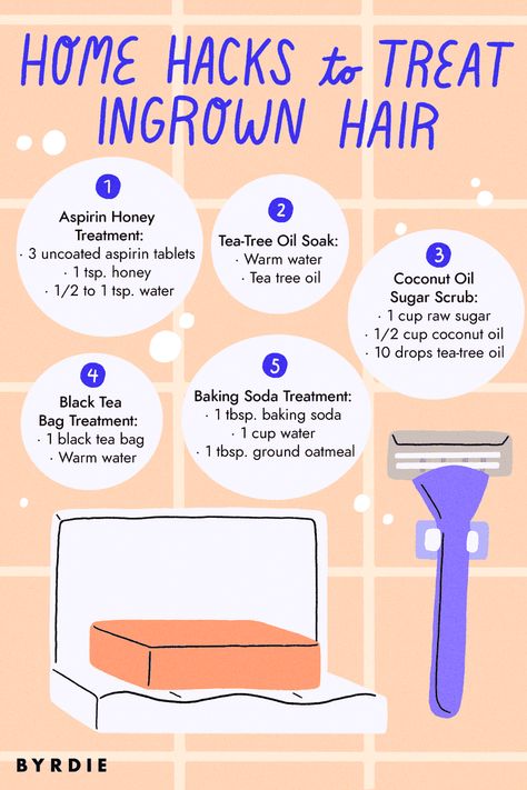 5 Easy DIY Remedies for Your Pesky Ingrown Hairs Treat Ingrown Hair, Ingrown Hair Remedies, Shaving Tips, Ingrown Hairs, Diy Remedies, Beauty Remedies, Hair Remedies, Unwanted Hair Removal, Manicure Y Pedicure