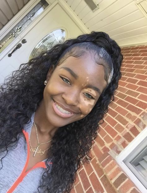 𝙋𝙞𝙣𝙩𝙚𝙧𝙚𝙨𝙩@𝙪𝙙𝙭𝙣𝙩𝙢𝙖𝙩𝙩𝙚𝙧 Blonde Lace Wig, Brace Face, Ponytail Wig, Lace Frontal Wigs, Dark Skin Beauty, Hair Blonde, Hair Life, Hair Quality, Lace Wig