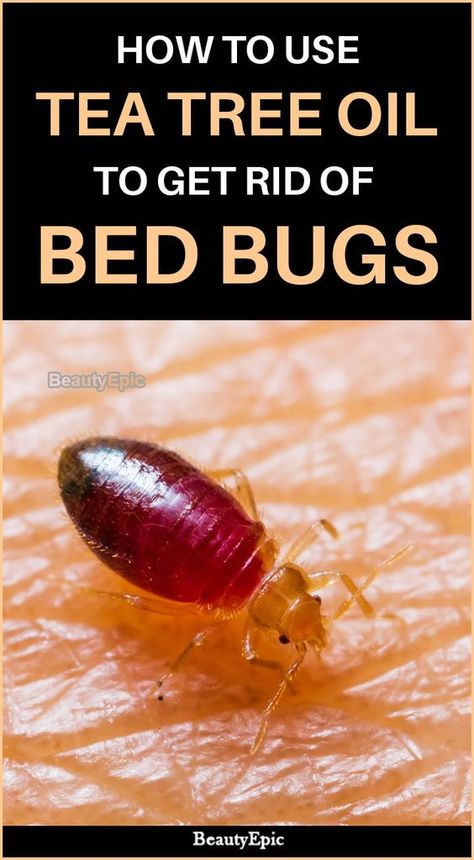 How to use Tea Tree oil To Get Rid Of Bed Bugs Bed Bugs Essential Oils, What Kills Bed Bugs, Bed Bug Remedies, Get Rid Of Bed Bugs, Bed Bug Spray, Bug Spray Recipe, Kill Bed Bugs, Rid Of Bed Bugs, Bed Bug Bites