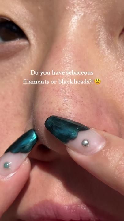 Soo Youn Lee on TikTok Sebaceous Filaments, Rid Of Blackheads, Acne Cleansers, Perfect Skin Care Routine, Foaming Face Wash, Get Rid Of Blackheads, Healthy Skin Tips, Facial Skin Care Routine, Clearer Skin