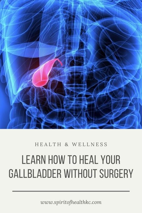 How To Cleanse Your Gallbladder, Natural Remedies For Gallbladder, Foods You Can Eat With Gallbladder Problems, Gallbladder Diet Sweets, Bile Producing Foods, Foods Good For Your Gallbladder, Gallbladder Healthy Foods, Natural Gallstone Remedy, How To Get Rid Of Gall Stones Naturally