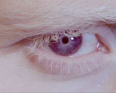 Albino Hair, Albino Eyes, Indigo Eyes, White Eyelashes, Violet Eyes, Eye Photography, White Eyes, Arte Inspo, Purple Eyes