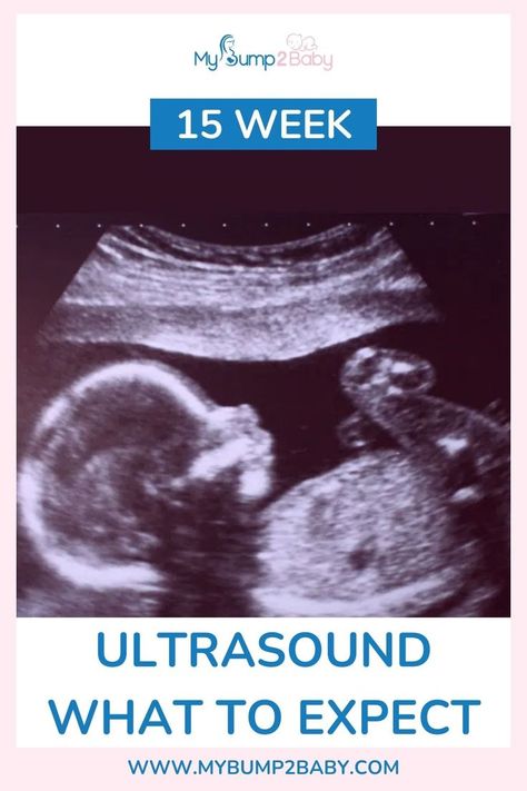 15 Week Ultrasound – What to Expect. 15 Week Ultrasound, 15 Weeks Pregnant, 39 Weeks Pregnant, Baby Ultrasound, All About Pregnancy, Pregnant Diet, Weeks Pregnant, First Trimester, Pregnancy Symptoms