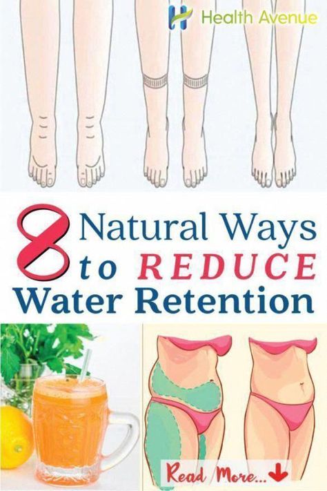 8 Natural Ways to Reduce Water Retention #reduceweight #HealthTips #HealthAdviceLine #NaturalRemediesImpetigo #AsthmaNaturalRemedies #HealthyFoodForHealthyLife #HealthMagazine How To Reduce Water Retention, Reduce Water Retention, Water Retention Remedies, Water Retention, Health Magazine, Health Advice, Reduce Weight, Blood Sugar, Natural Remedies