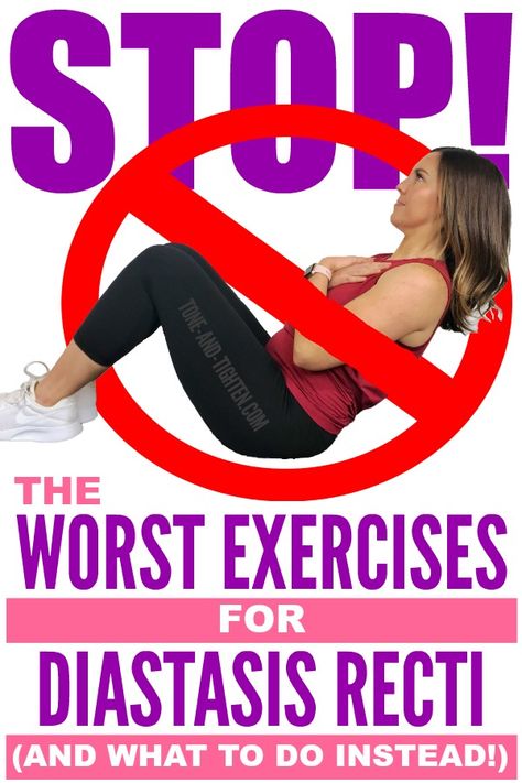 The WORST exercises for diastasis recti... and what to do INSTEAD! Video instruction and demonstration from a physical therapist. Split Abs Diastasis Recti Exercise, Diastis Recti Exercises Workout, Diastasis Exercises, Diastis Recti, Prevent Diastasis Recti, Exercises For Diastasis Recti, Postpartum Abs, Rectus Abdominis Muscle, Muscle Belly